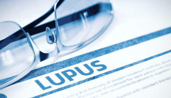 Systemic Lupus Erythematosus