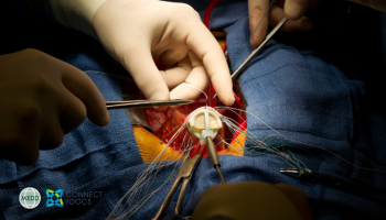 Minimally Invasive Cardiac Surgery