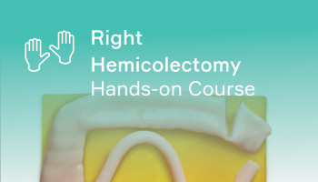 Robotic Assistsed Right Hemicolectomy - Hands-on Course